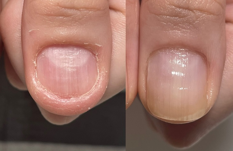 爪のケアや自爪の育成にこだわったネイルサロン | 仙台でネイルケアなら爪育成ネイルサロンティンブレ